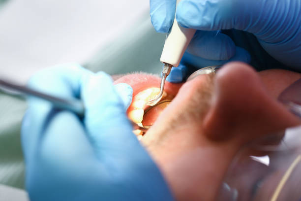 Best Emergency Gum Treatment in Shawneeland, VA